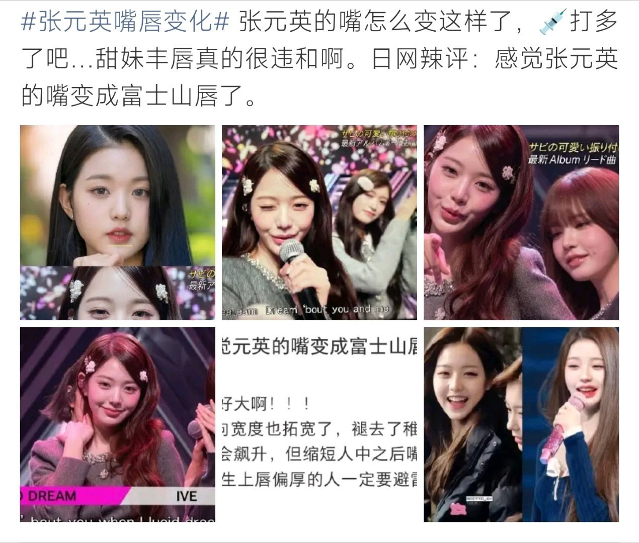 张元英嘴唇变化网友热议张元英唇部状态变化，对比旧照差异明显，被日网友调侃富士山唇