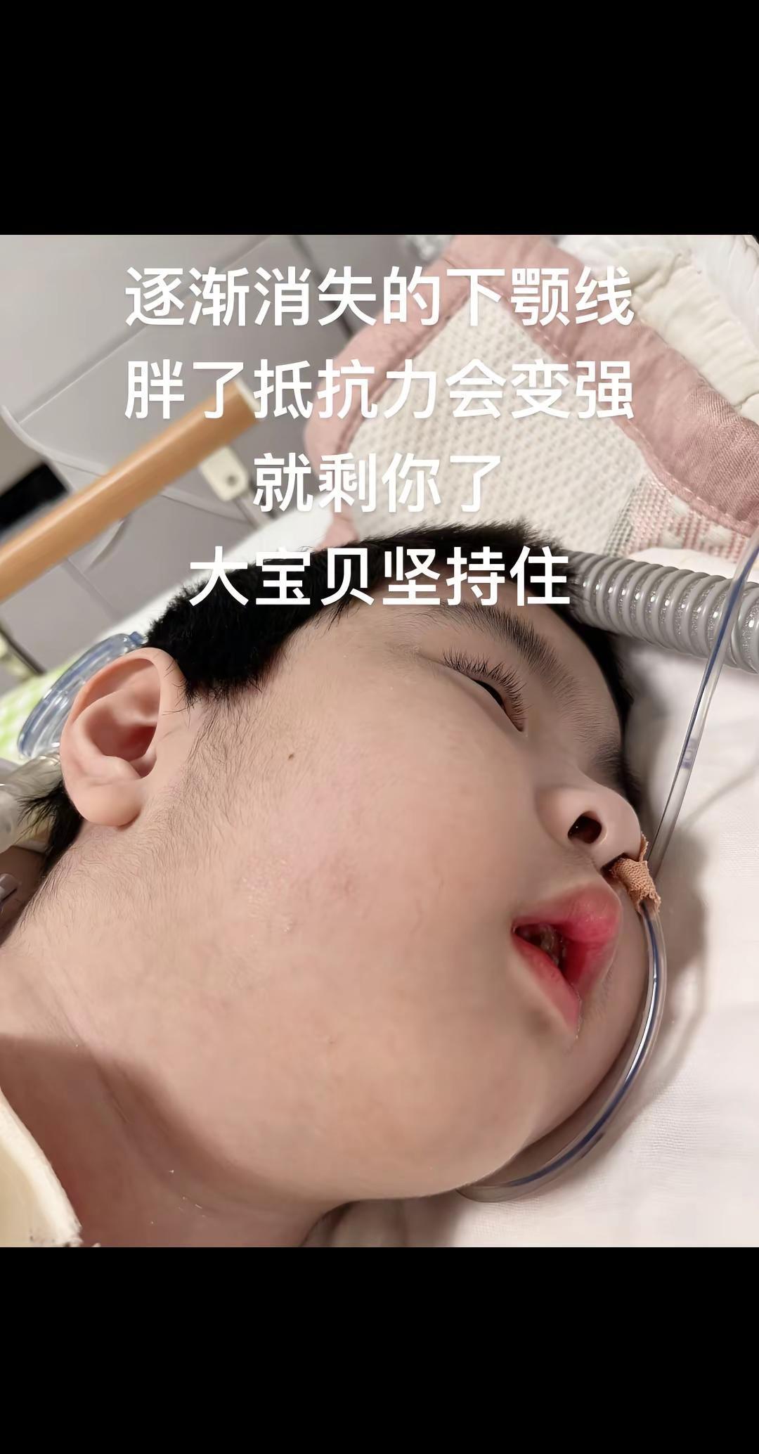 一家子轮流感冒，像传接力棒。
爸刚缓两天，妈又咳上了，娃半夜烧得滚烫。
屋里通风