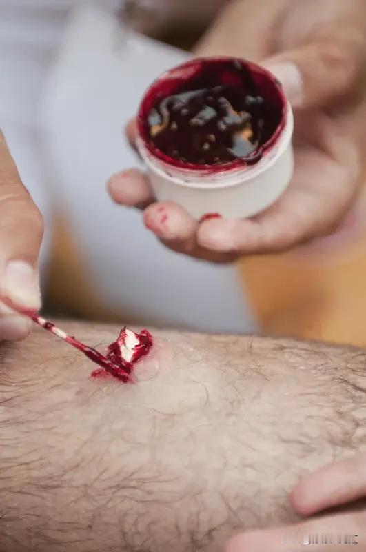 被老鼠咬了可别不当回事，有些症状得重点留意。
首先是伤口周边，要是出现疼痛、红肿