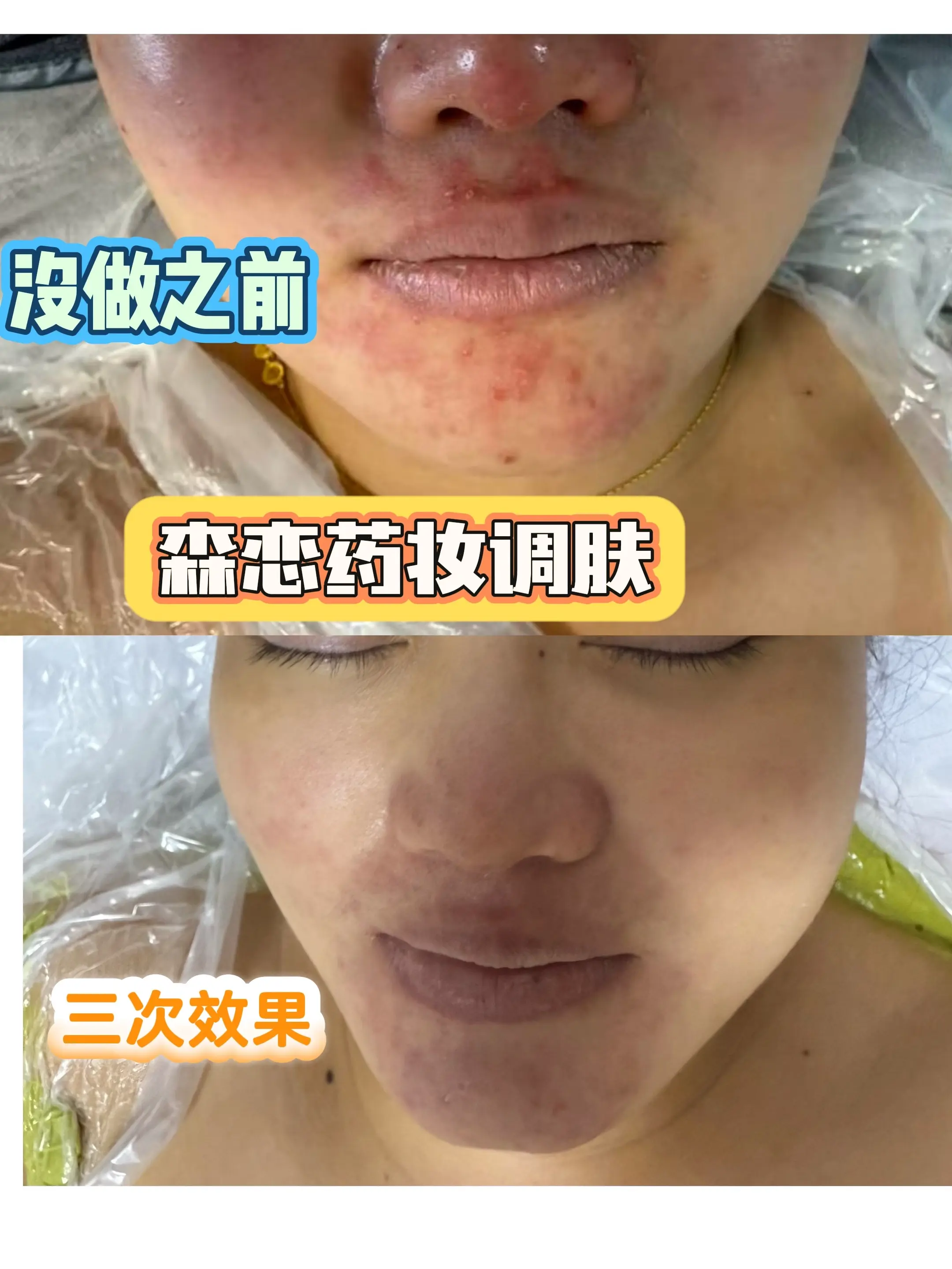 真实护肤案例 素颜肌效果对比 皮肤逆袭变美不是梦
