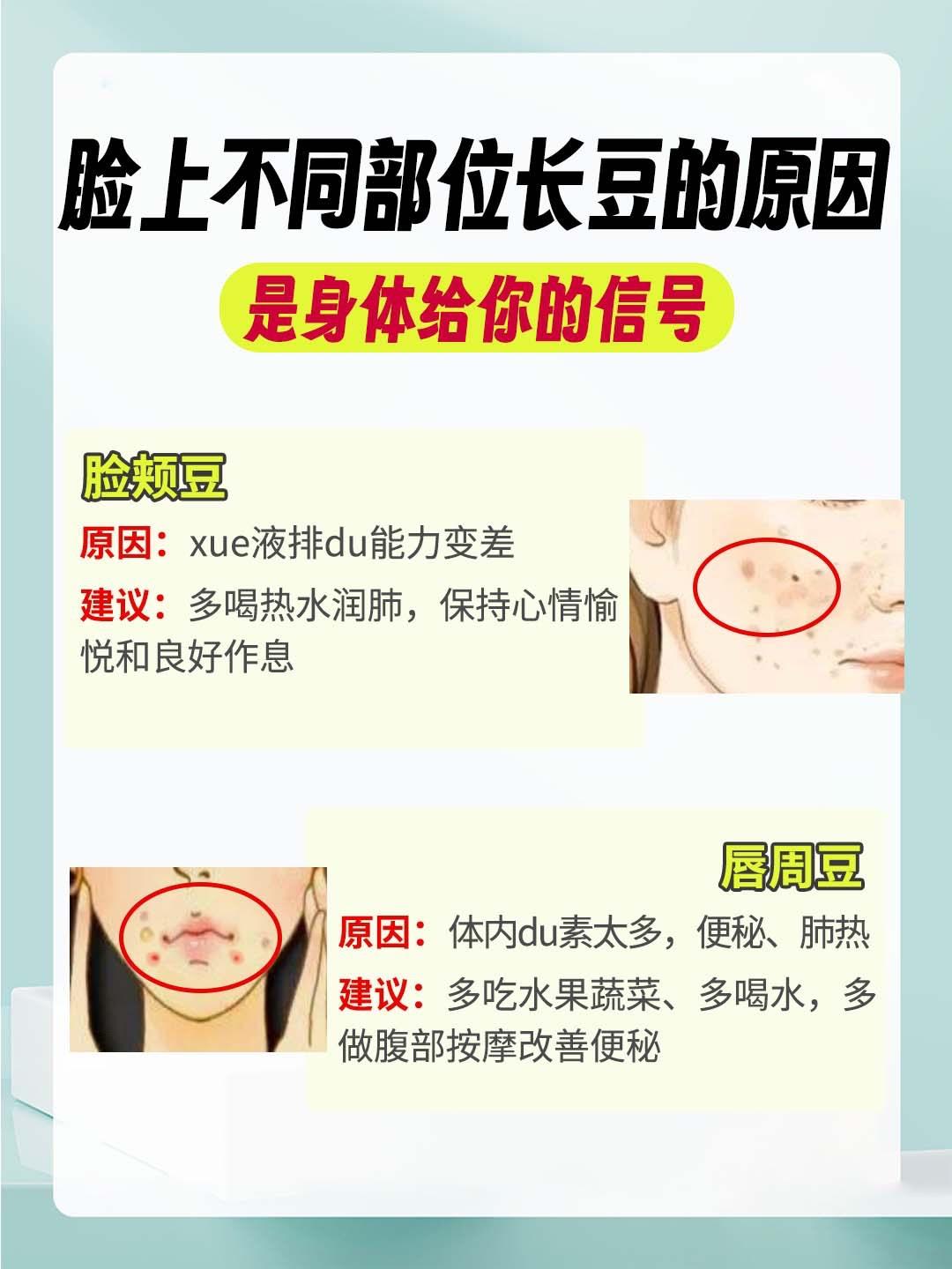 你知道自己平常哪里爱长痘痘吗？