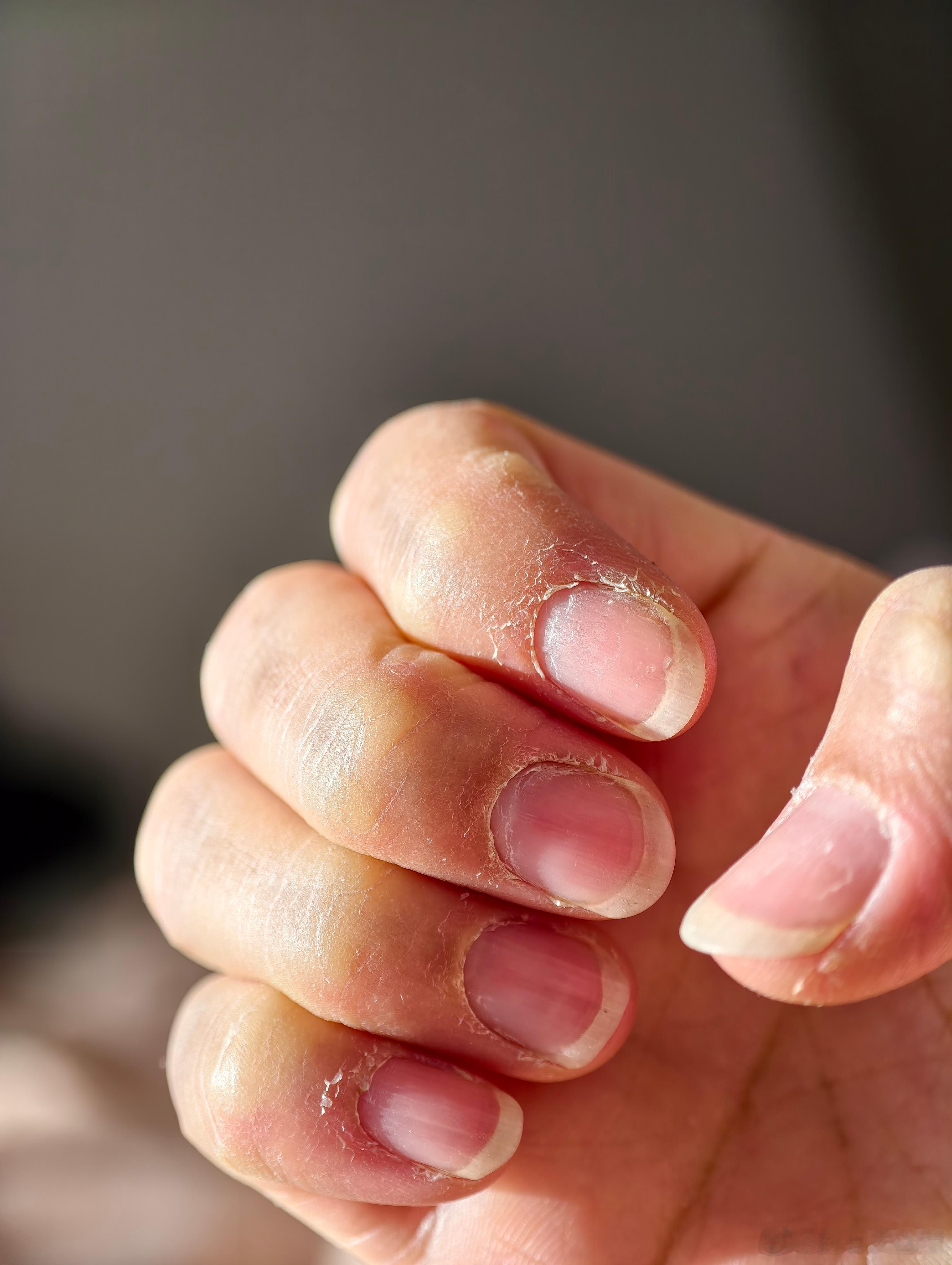 手搬家搬的已经废了，这样的手还有人愿意牵吗？