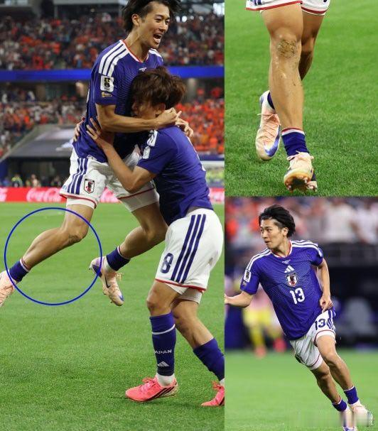日本球员不戴护腿板违规吗 不少观众看比赛时都留意到这个画面，球员球袜滑到脚踝，看