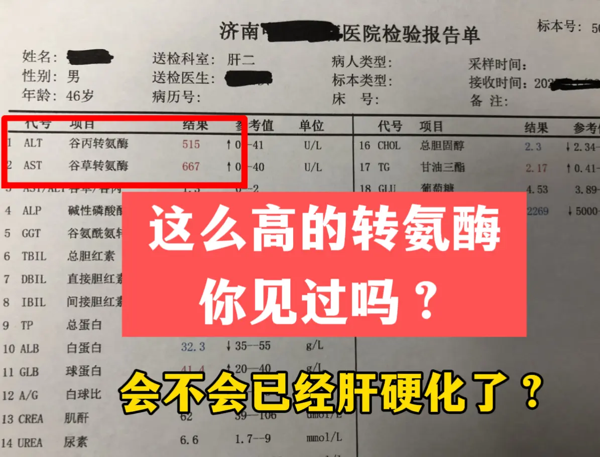 昨天门诊来了个38岁的山东男士，浑身乏力没当回事，最近一段时间脸色还发...