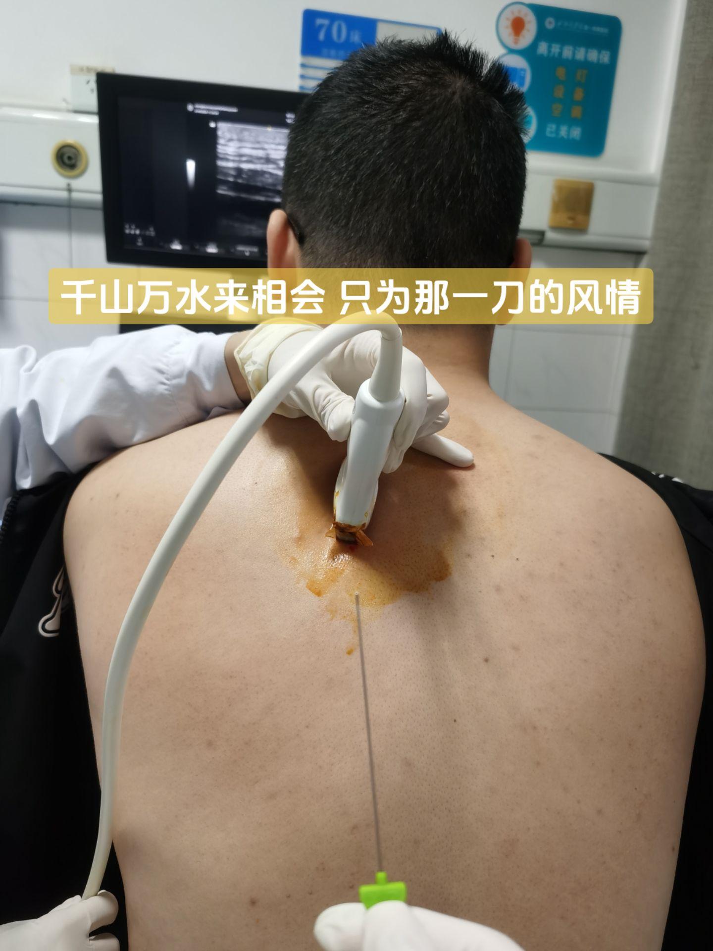 坐了一天一夜高铁而来，安排！
