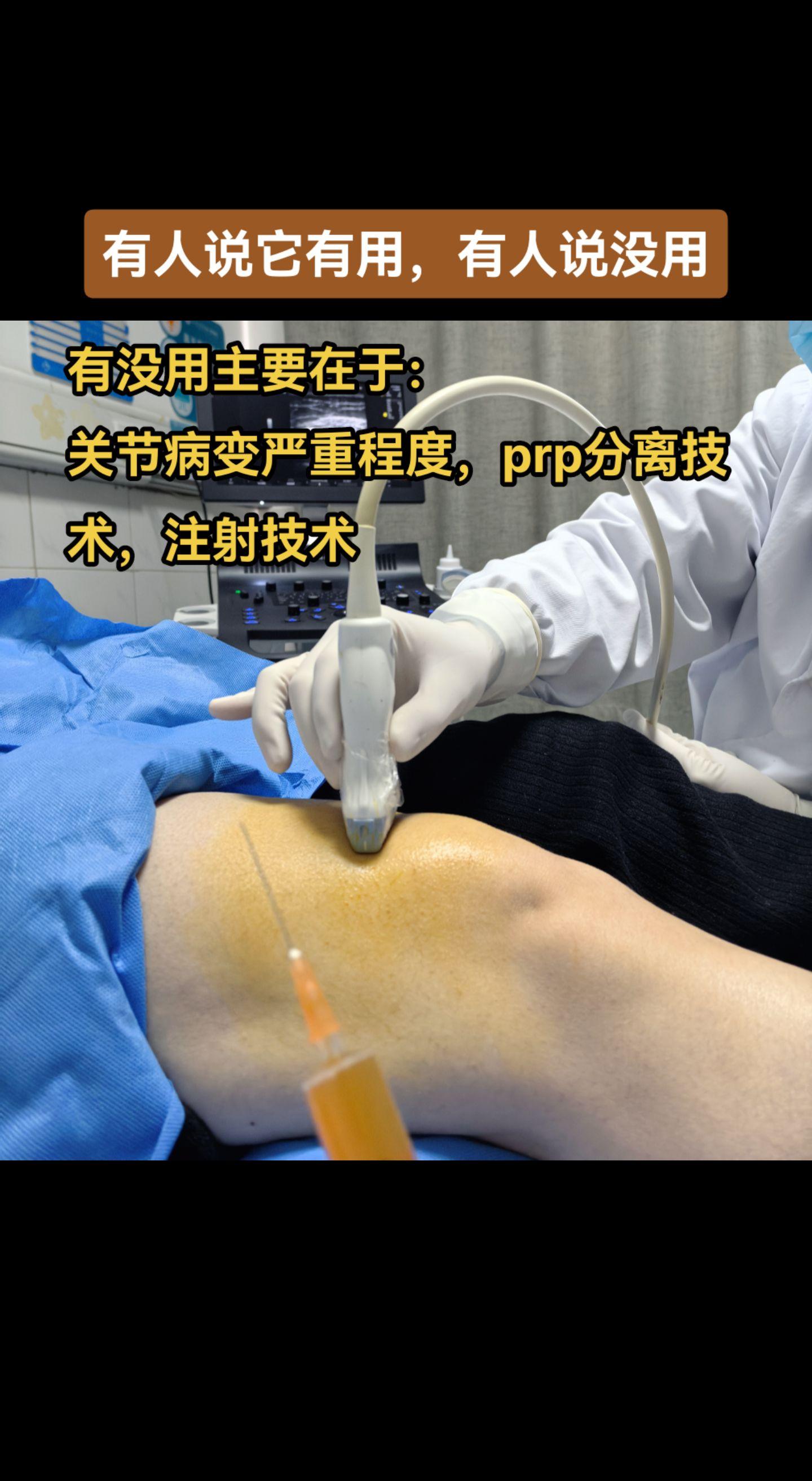 适合于轻中度关节病变，普遍反应良好（分离技术注射技术过关的话），重度差点儿意思。