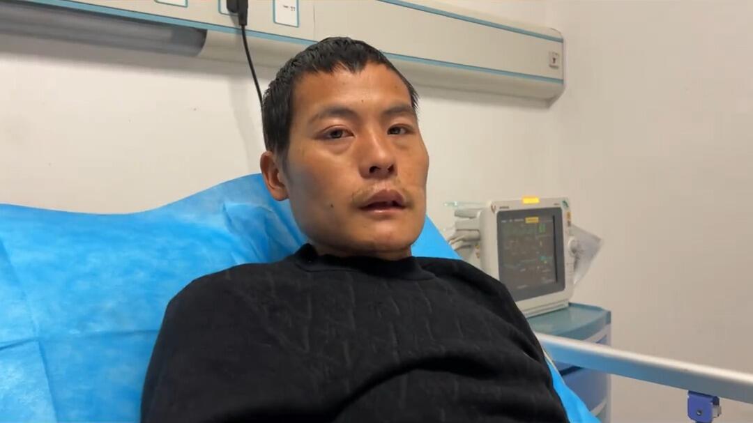 面对比赛带来的关注度，刀疤哥表示 "热度终会褪去"，赛后仍想回归普通工作岗位，"