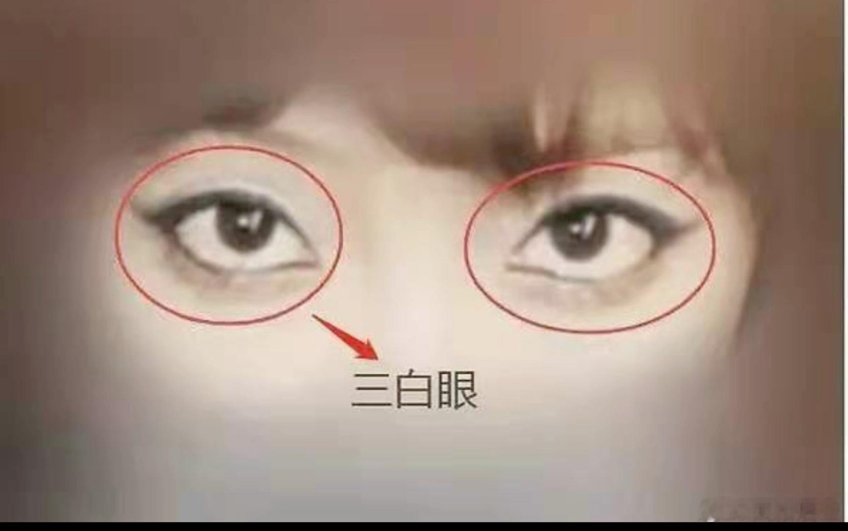 三白眼 眼神凶狠人下三白的眼神，被认为具有高度的隐匿性和行事果断的特点。在专业领