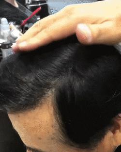 每一根头发都很宝贵，要承担一大片区域 