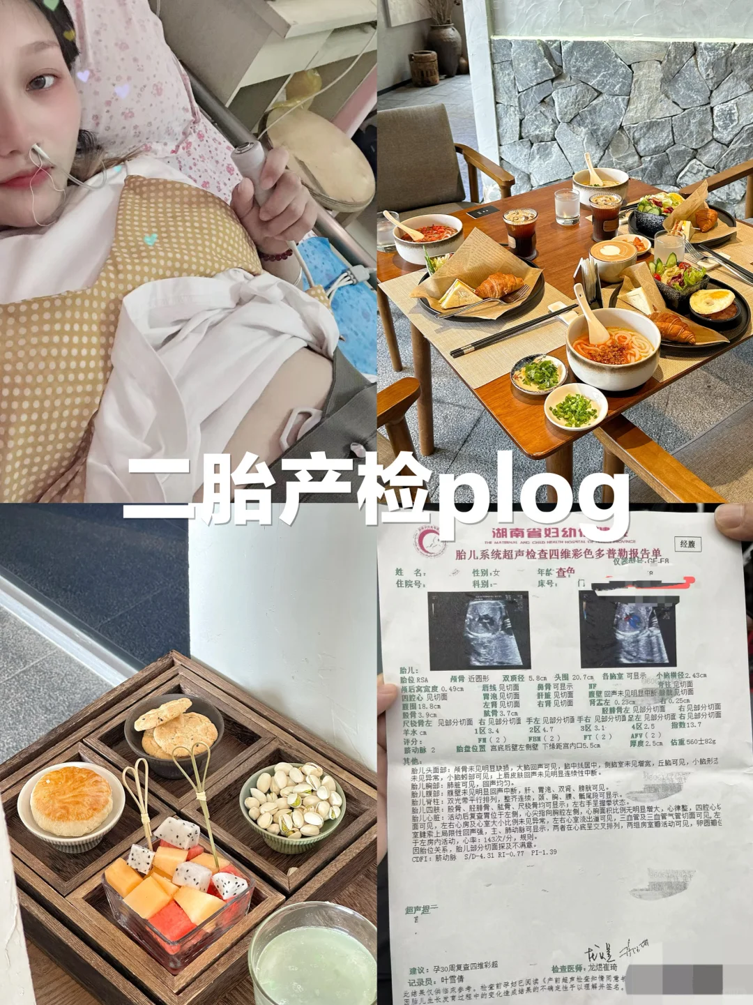 产检plog ｜四维顺利通过啦✌️ 其实孕检🤰有好多需要孕妈妈注意的...