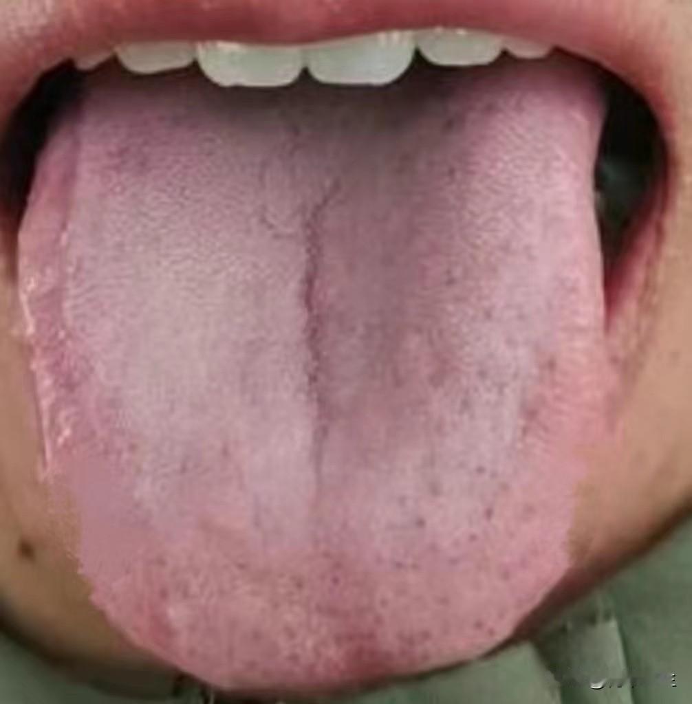 有些肝郁不能上来就理气，越理越麻烦
 
有些患者确诊你是肝郁，但是用了舒肝的药却