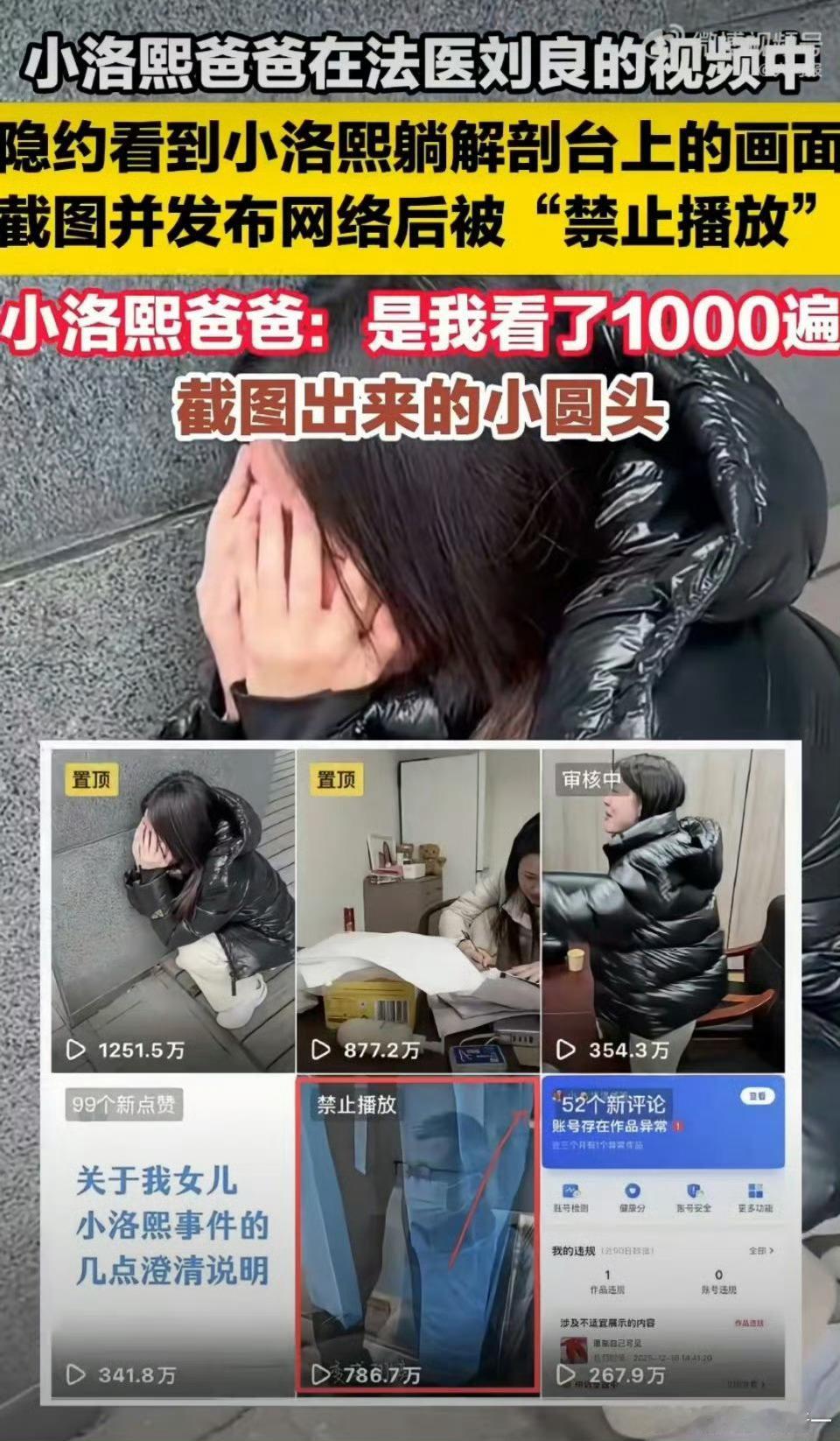 小洛熙爸爸发解剖台画面被禁止播放 平台审核机制这个是有规则的，这个不存在“阴谋论