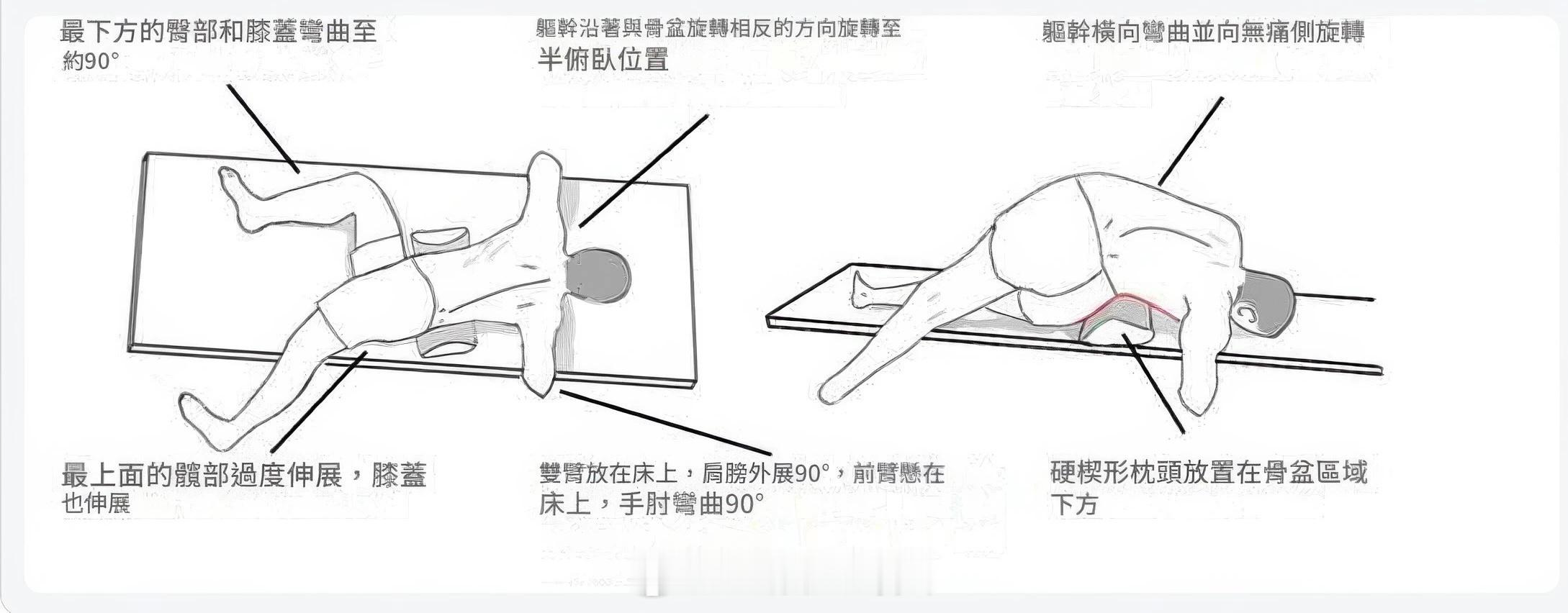 一个能缓解腰突疼痛的简单动作：MRCAR ​​​