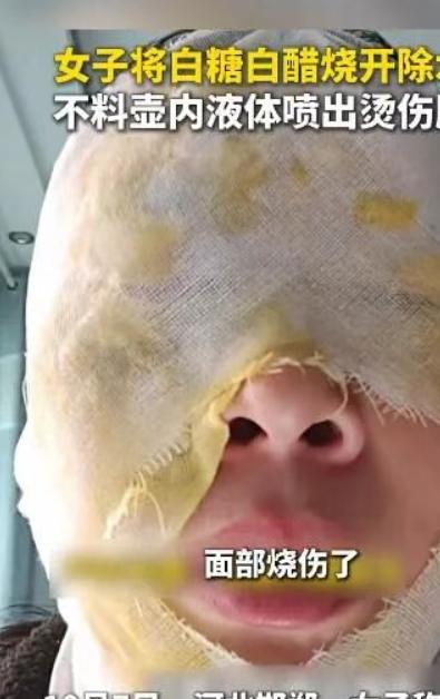 刷到邯郸吴女士的事儿我真的惊出一身汗就想给保温壶除个垢，居然被滚烫液体喷得满脸伤