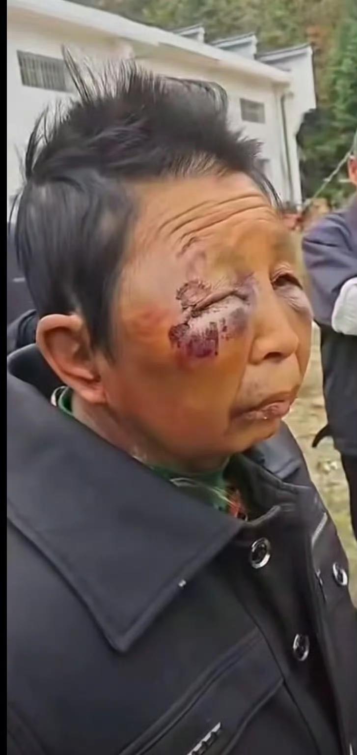刷到平江通报的75岁男子酒后两次殴打妻子的新闻，只觉得愤怒又心寒！一把年纪本该是