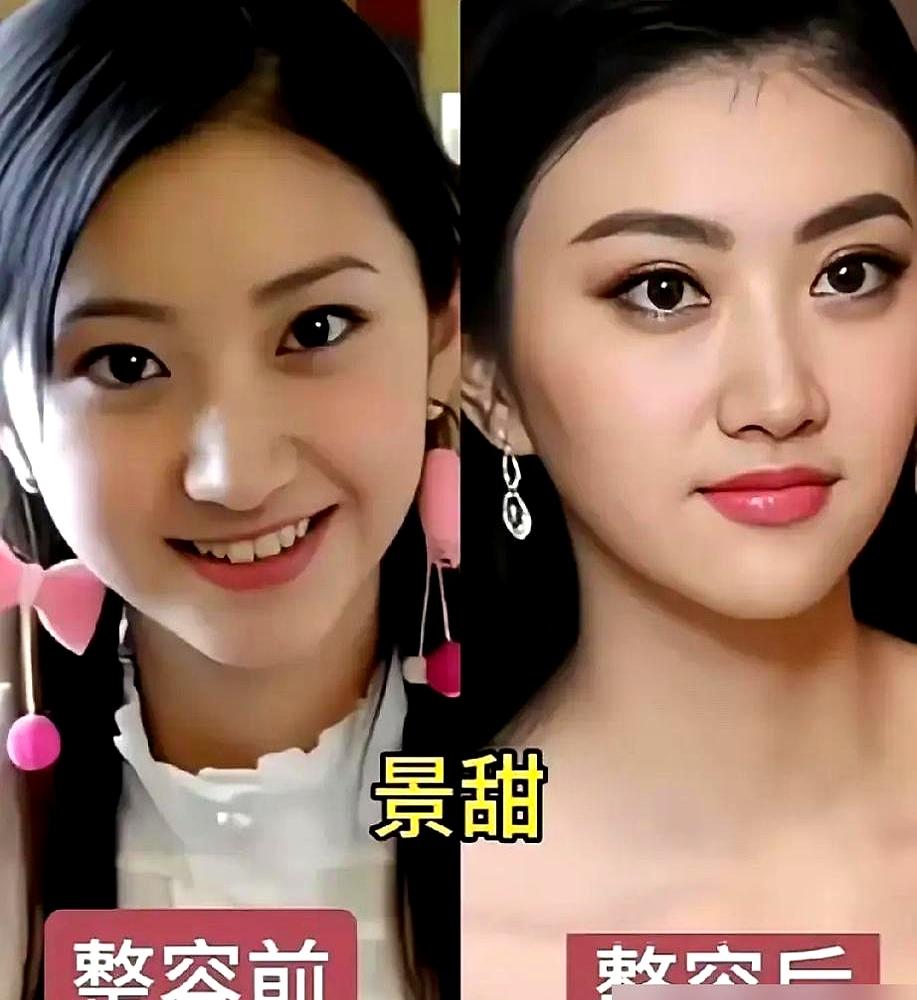 “别做秀了，血都没出贴什么创可贴！”
 

秦海璐当着几十号人，还有好几台摄像机