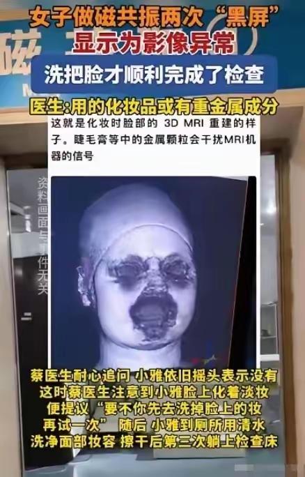 解释不清了！福建一29岁女生头晕，去医院做头颅磁共振。不料，连续2次扫描，都因面