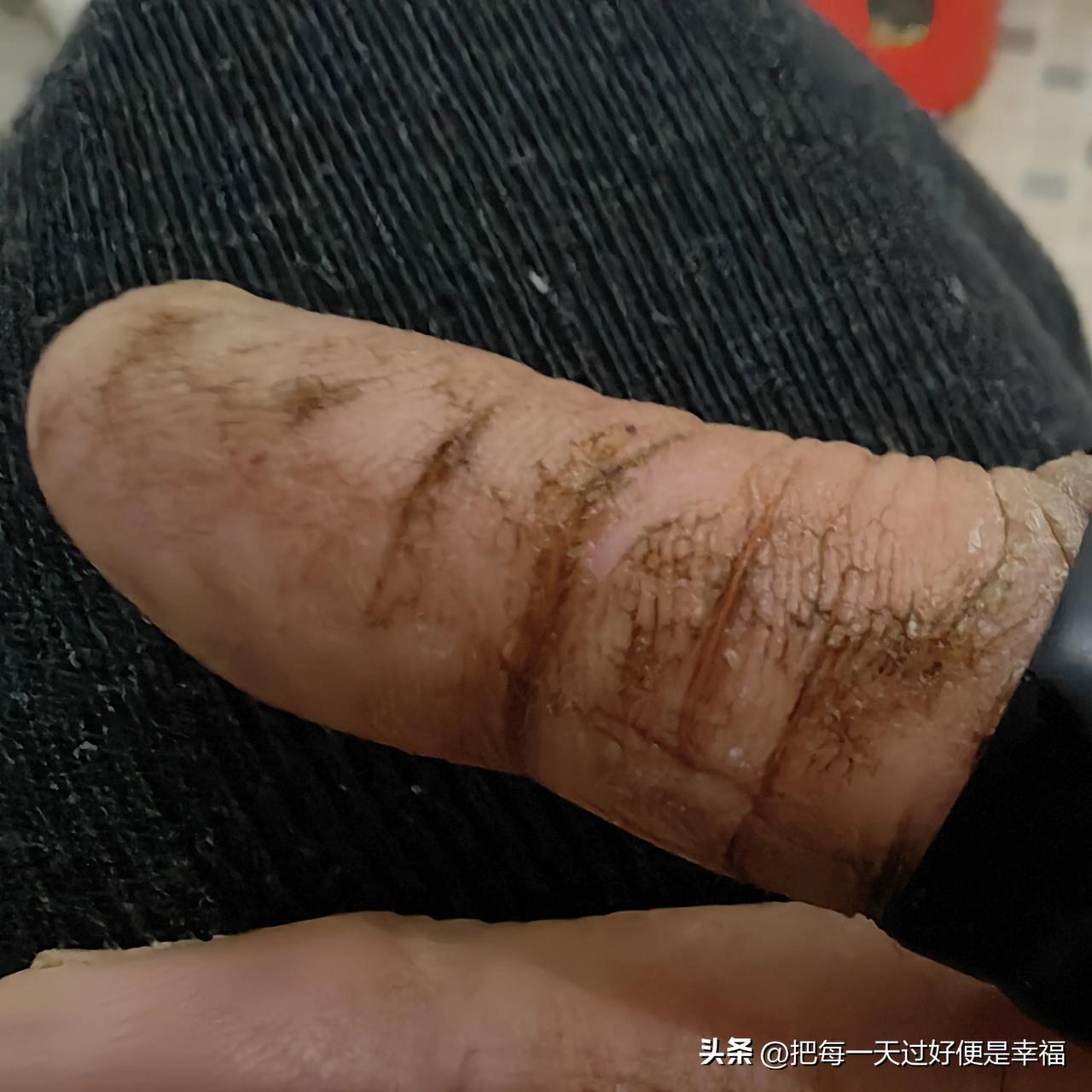 如果你的长辈有这样的手指，千万不要自卑，他（她）是为你的后代崛起而甘愿作了铺垫，