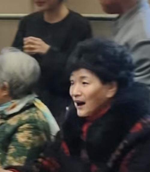 这位年长女性已经80岁了，她的双眼皮75岁时动手术割的，我说你们能相信吗？我自己