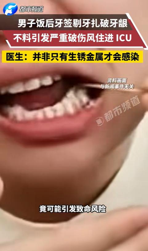 “悲剧还是发生了！”近日，湖北武汉，一男子饭后用牙签剔牙时，不小心扎破了牙龈，出