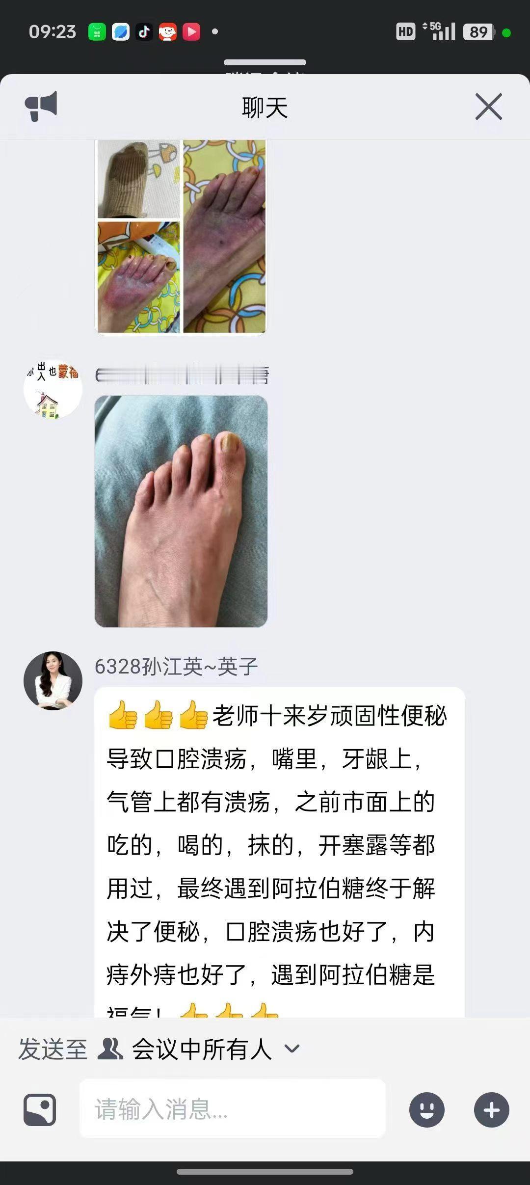 十来岁孩子顽固性便秘太遭罪了，
满嘴溃疡、牙龈溃疡、甚至痔疮都找上门，
各种药、