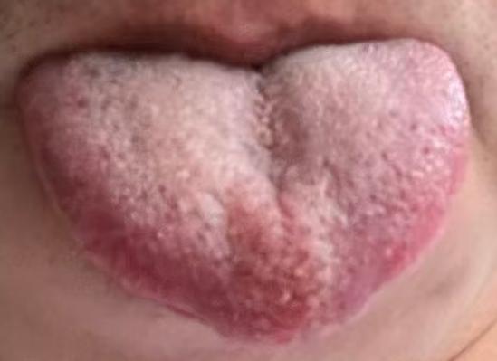 婚后纵欲伤肾阳，温和调补重振阳气






很多朋友年纪轻轻婚后不知道节制让自