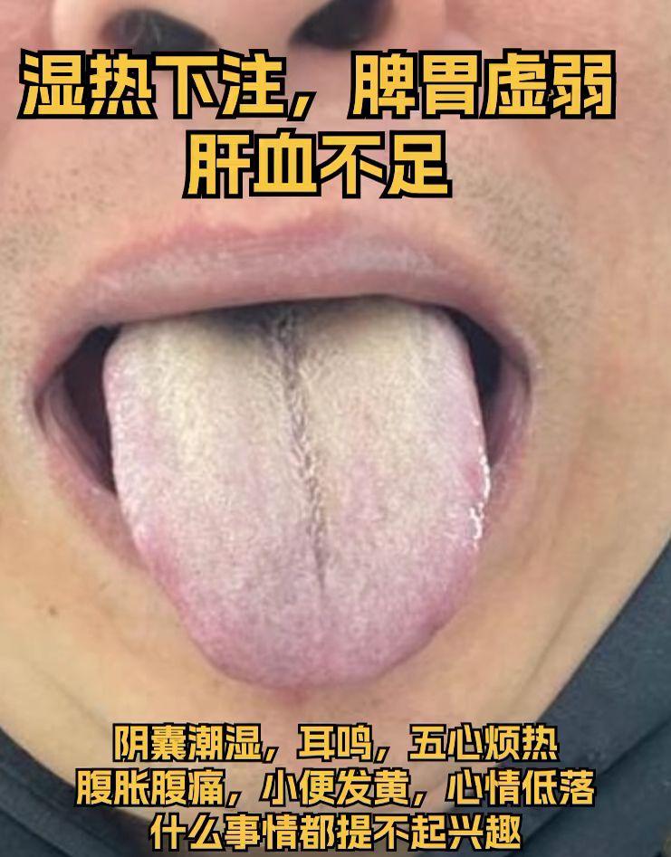 三种不同舌象分析 看看你的身体中了吗
