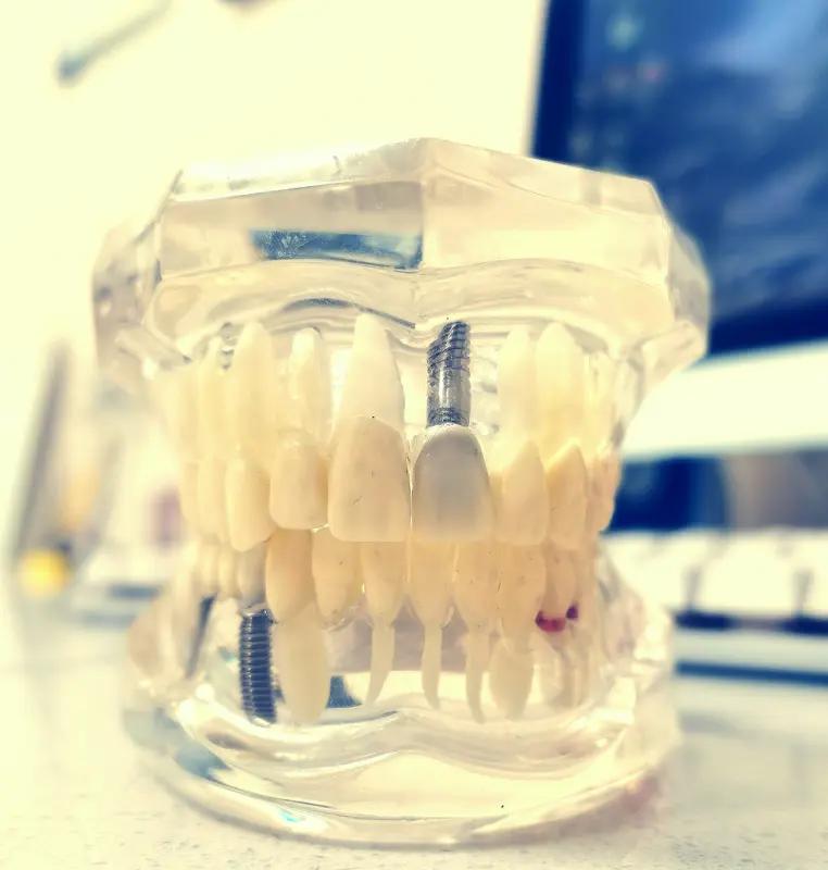 长智齿会把整排牙推向前吗
 
家人们谁懂啊！最近一照镜子差点崩溃——下排牙居然越