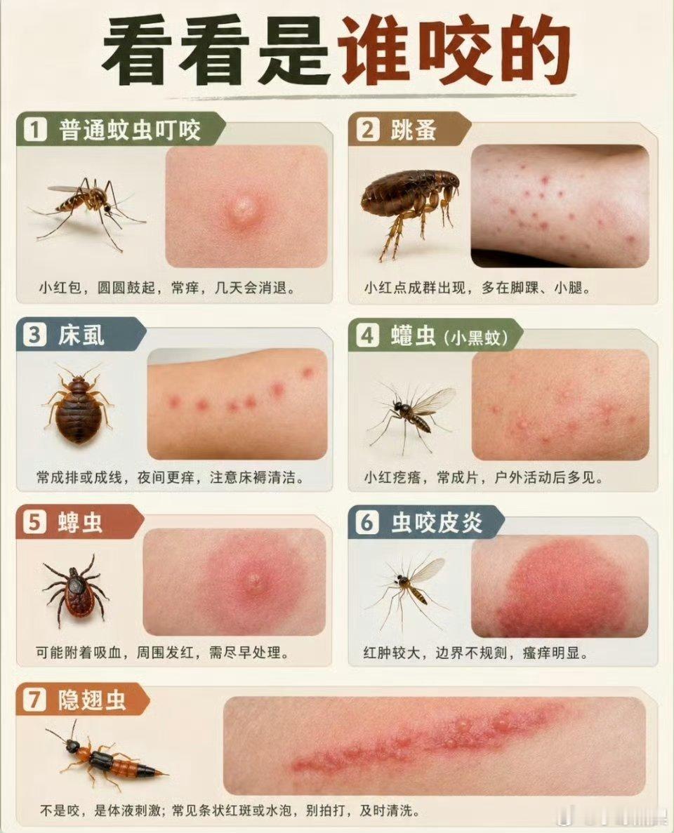 李一桐被毒虫咬了脸被咬的地方离眼睛好近啊，一定要及时去医院检查就医，姐姐要健健康