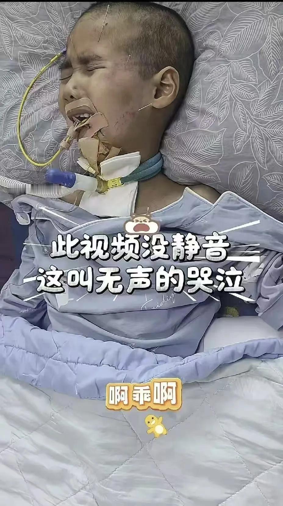 刘楚熙只有8岁，在扎针灸的时候疼得直咬牙，直冒冷汗，依然没有哭出来，他都在用什么