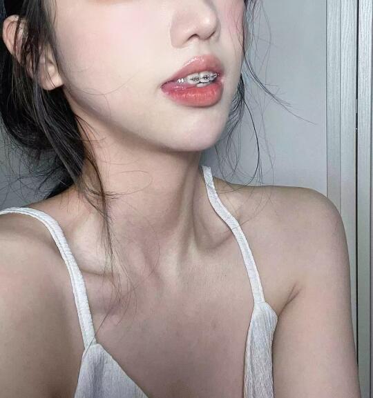 太原正畸找到山西二院主任，只要1.3w➕