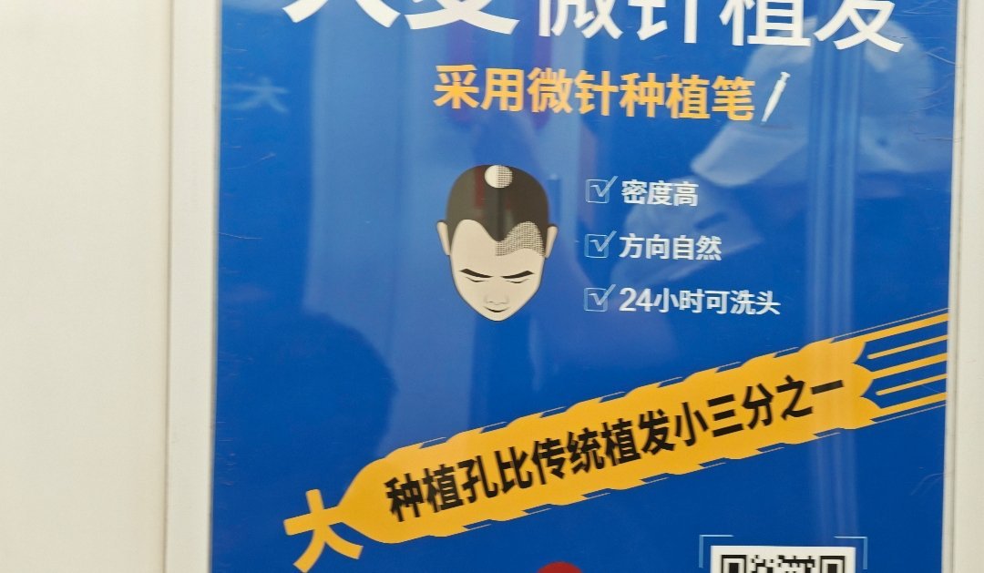 理解了半天这个大种植孔比传统植发小三分之一 