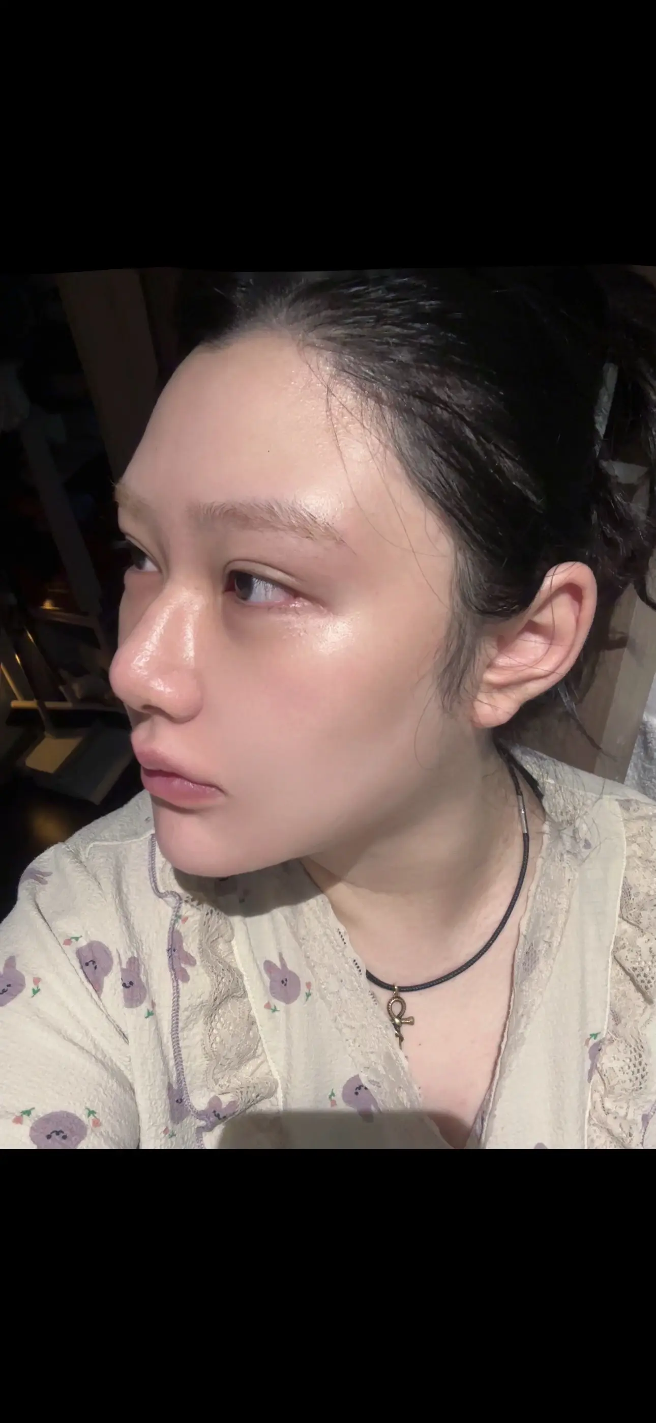 当时好多人说我眼睛做毁了，我说给点恢复。时间，现在不特意说根本看不出来...