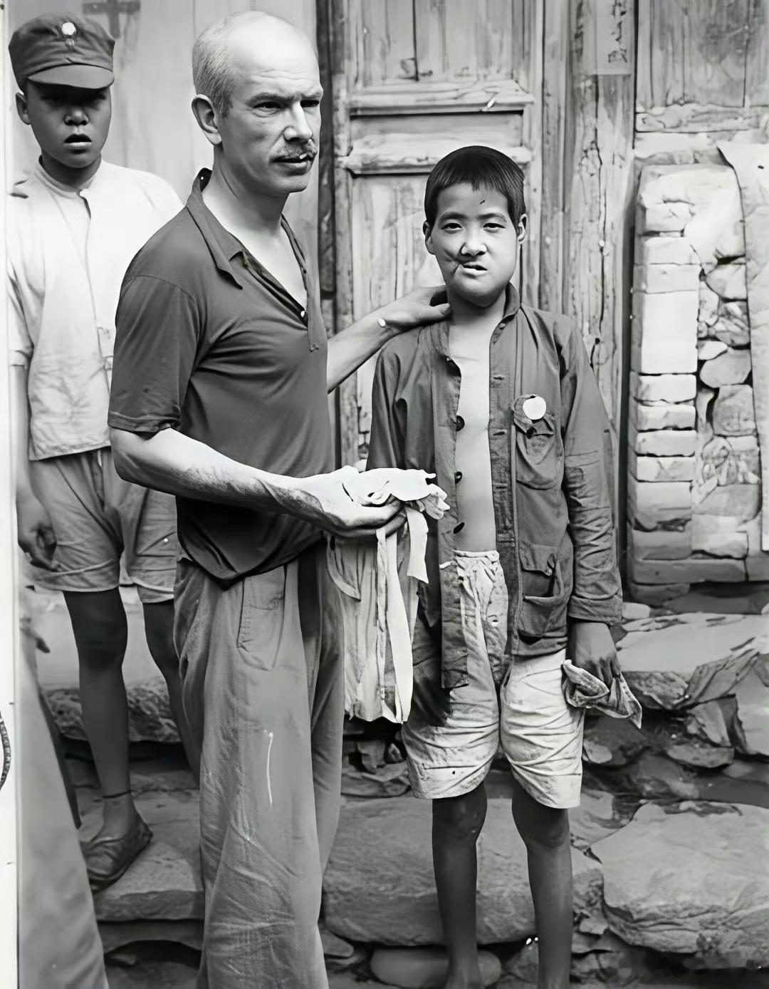 1939年，白求恩给面部中弹的小八路拆线。 