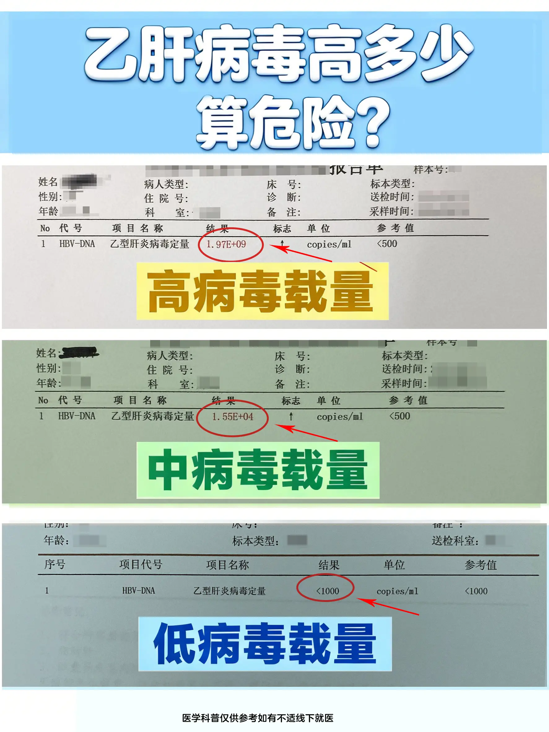 乙肝病毒DNA载量是评估病情的关键指标，一般来说，当数值超过10^5c...