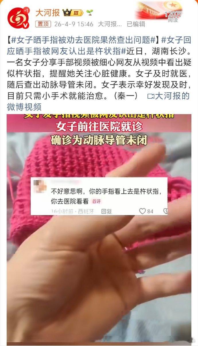 女子晒手指被劝去医院果然查出问题 不是拿手机拿的手指变形了吗 这介网友也是神了！