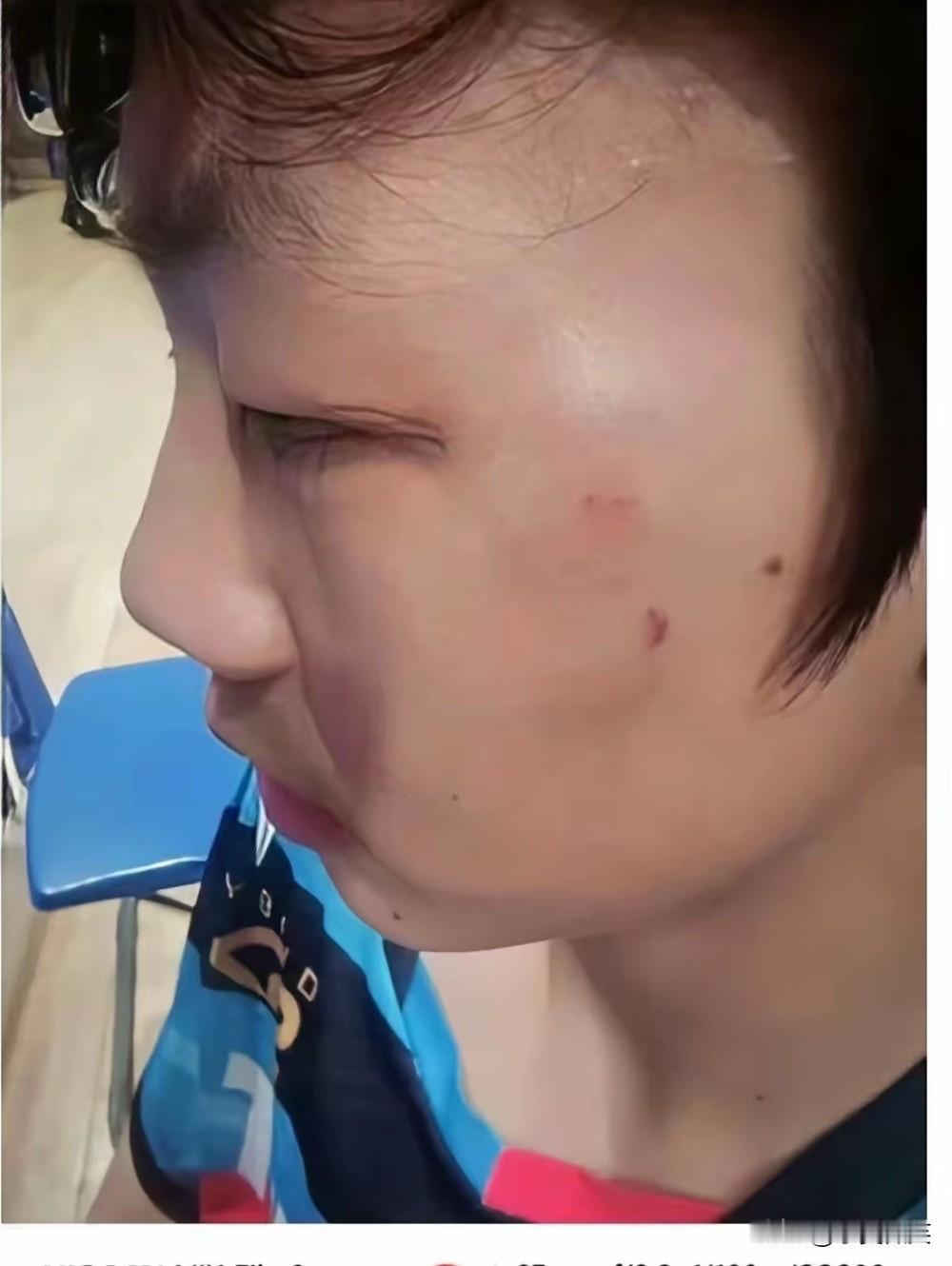 省乒协给出了3条处罚措施，我建议要换成这样的3条，否则难以杜绝以后类似情况的出现