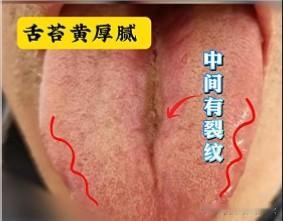 天天动手，肆无忌惮，你才26啊，你这后面结婚咋办[what][what][wha