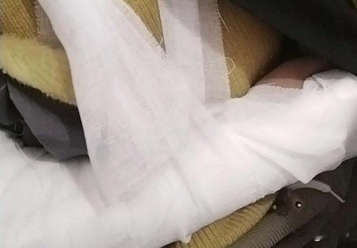 真是心疼死我了，早上去学校还是好好的，课间操老师就打电话来说“孩子出了事”，被同