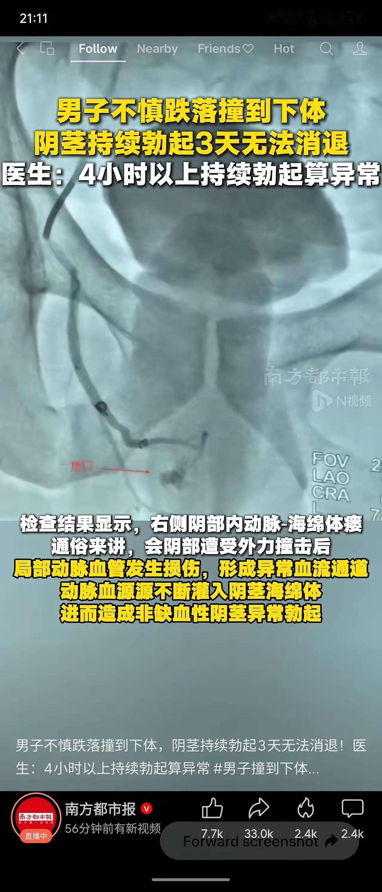 笑不活了！一男子不小心跌落后撞到下体，竟然持续勃起三天无法自行消退！

这种现象