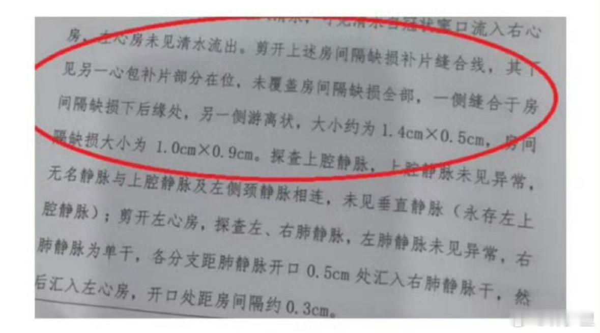 专家称小洛熙的房间隔缺损确实存在这个事，发声也发声了，闹了闹了。尸检报告出来，该