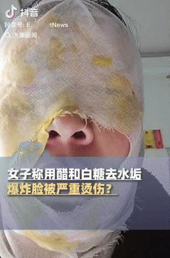 这下悲剧了！10月9日报道，河北邯郸，一女子在家烧开水时，见保温壶里有很多水垢，