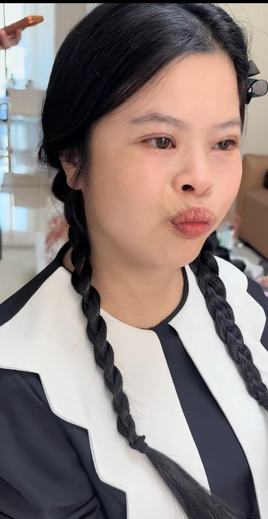 再把嘴巴整容就完美了，从一个丑小鸭蜕变成了白天鹅。
