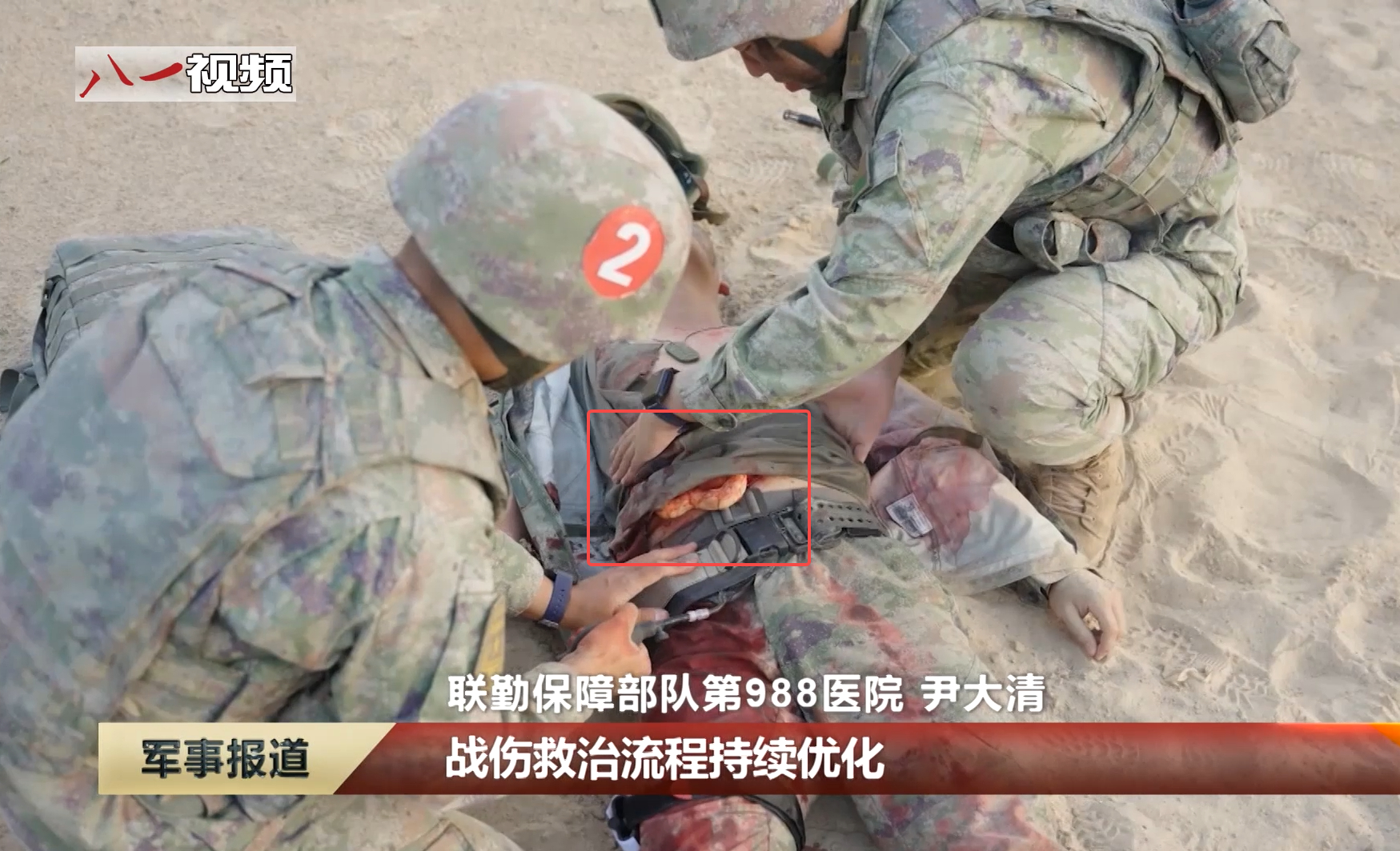 战伤救治演练，模拟肠子爆出 ​​​