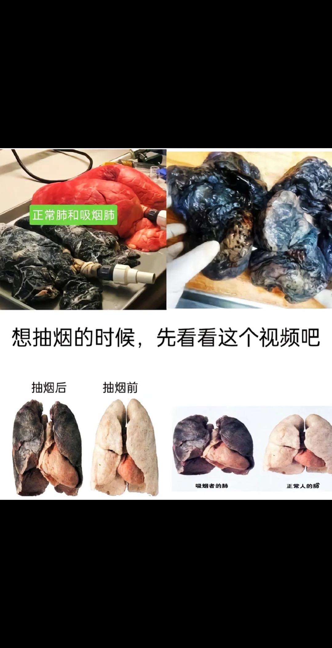 看到这些图片，你还敢吸烟吗？！