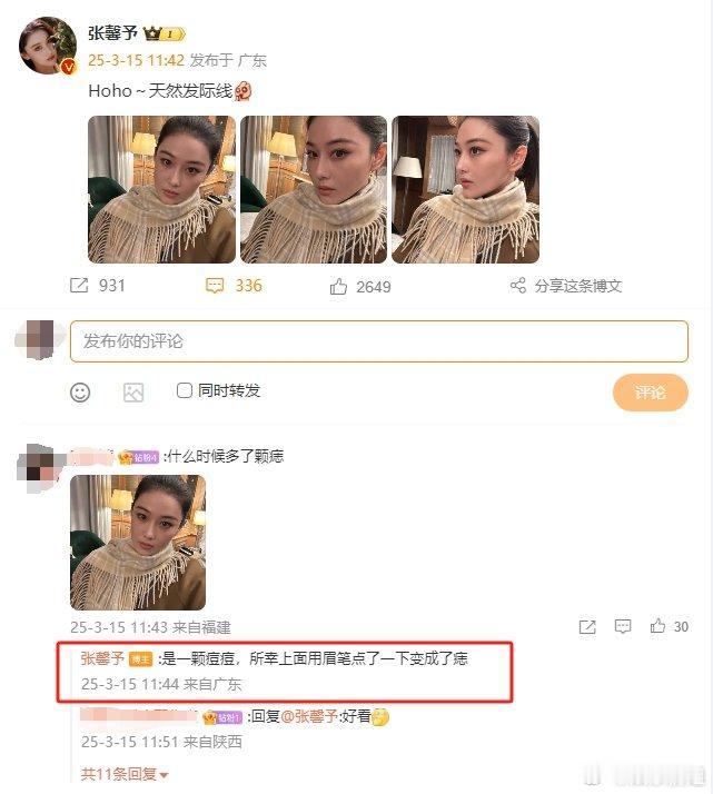 张馨予把痘痘点成痣张馨予高颅顶好优越啊，羡慕姐姐的天然发际线[哇]痘痘点成痣这个