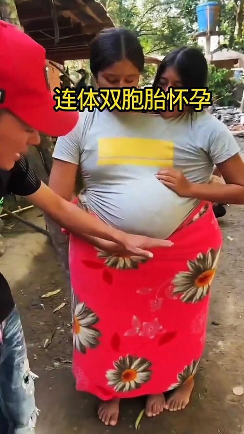 辽宁抚顺30岁孕妇王女士去年9月自然受孕后，在11月至12月的四次产检中，胎儿数