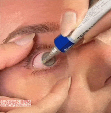 抗生素眼药膏[馋嘴]角膜炎什么的，就需要这玩意，涂上之后眼睛都睁不开~ 