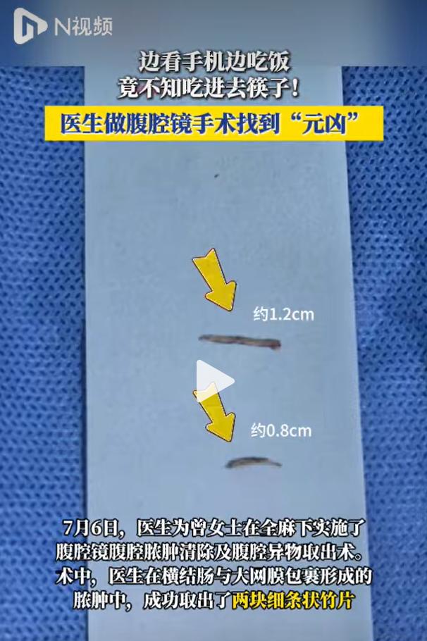 广州医科大学附属市八医院胃肠外科最近接诊了一名年轻女生，持续腹痛发烧怎么都不见好
