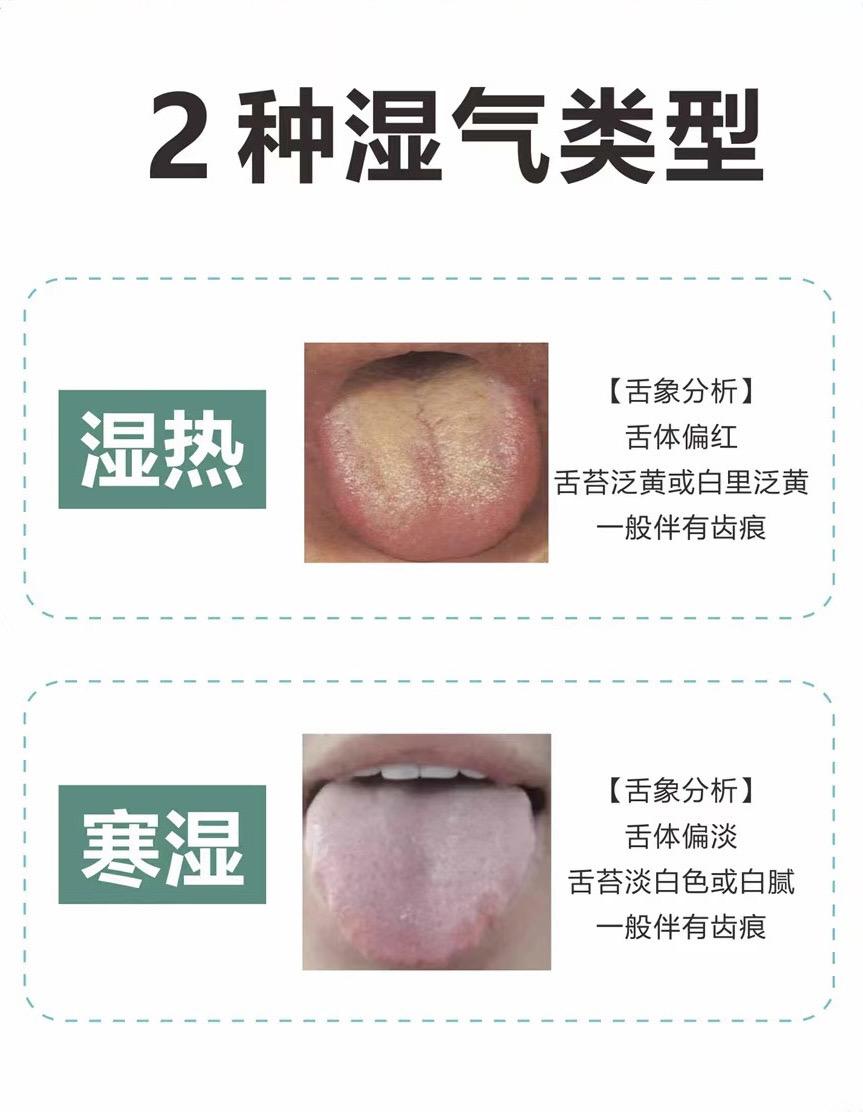 #医学科普 #舌苔辨证 #中医养生 #养生
